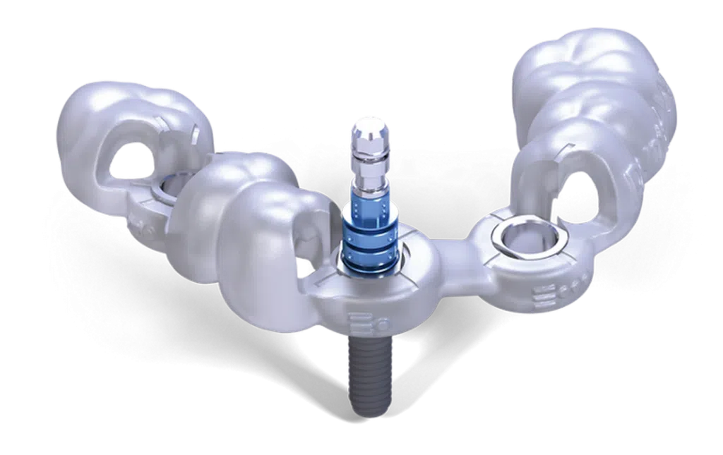 Ghid chirurgical pentru implant dentar